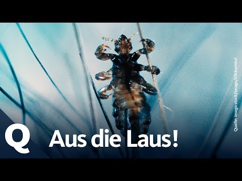 Kleine Blutsauger: Was machen Läuse im Haar? | Quarks