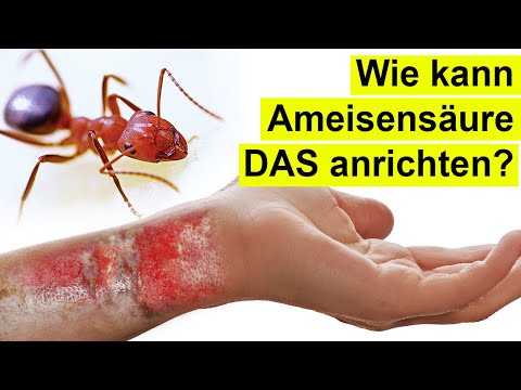 So kann Ameisensäure tödlich sein