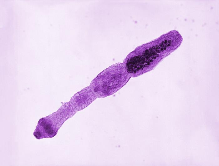 Fuchsbandwurm - Bandwürmer beim Hund - Echinococcus multilocularis